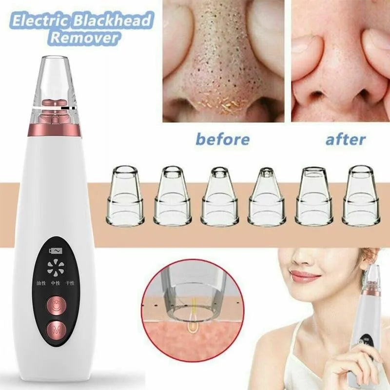 USB Charging Face Pore Vacuum Blackhead & Acne Remover Deep Cleansing Skin Care Tool with Black Dot Cleaner for Pimple Removal