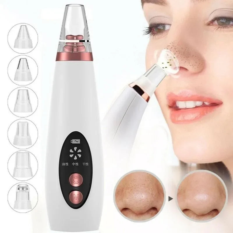 USB Charging Face Pore Vacuum Blackhead & Acne Remover Deep Cleansing Skin Care Tool with Black Dot Cleaner for Pimple Removal